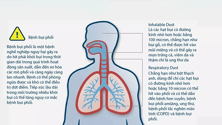 Nguyên nhân gây ra căn bệnh bụi phổi ở người lao động