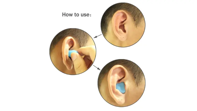 Hình 1. Cách sử dụng nút tai bằng sáp